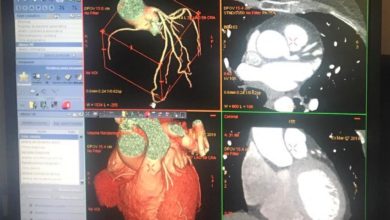 Photo of ASP Enna. Presso l’Ospedale Umberto I, attivo il servizio di Cardio Tac