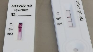 Photo of Coronavirus, partono nell’ASP di Enna le chiamate per i test sierologici.